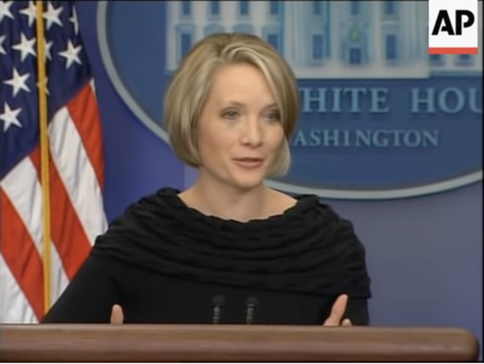 Dana Perino with a black eye